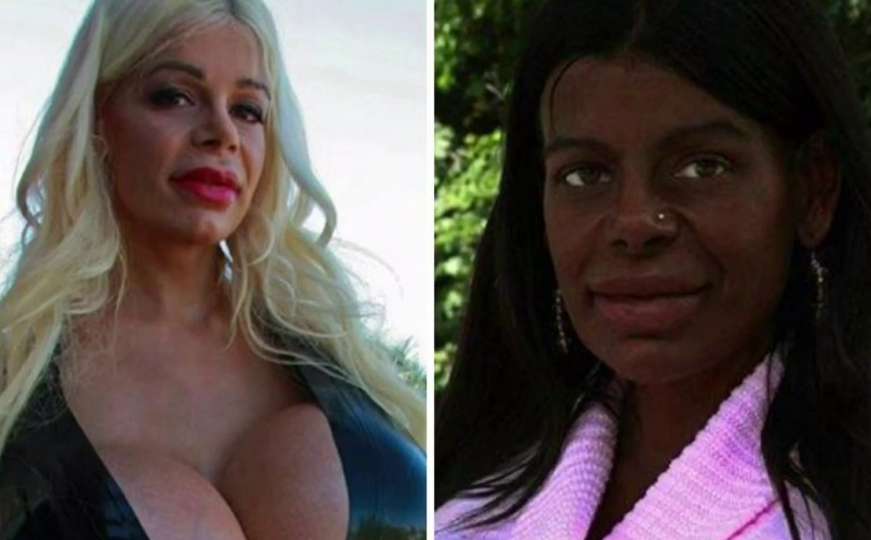 Model iz Njemačke promijenila boju kože, tvrdi da će roditi crnu djecu